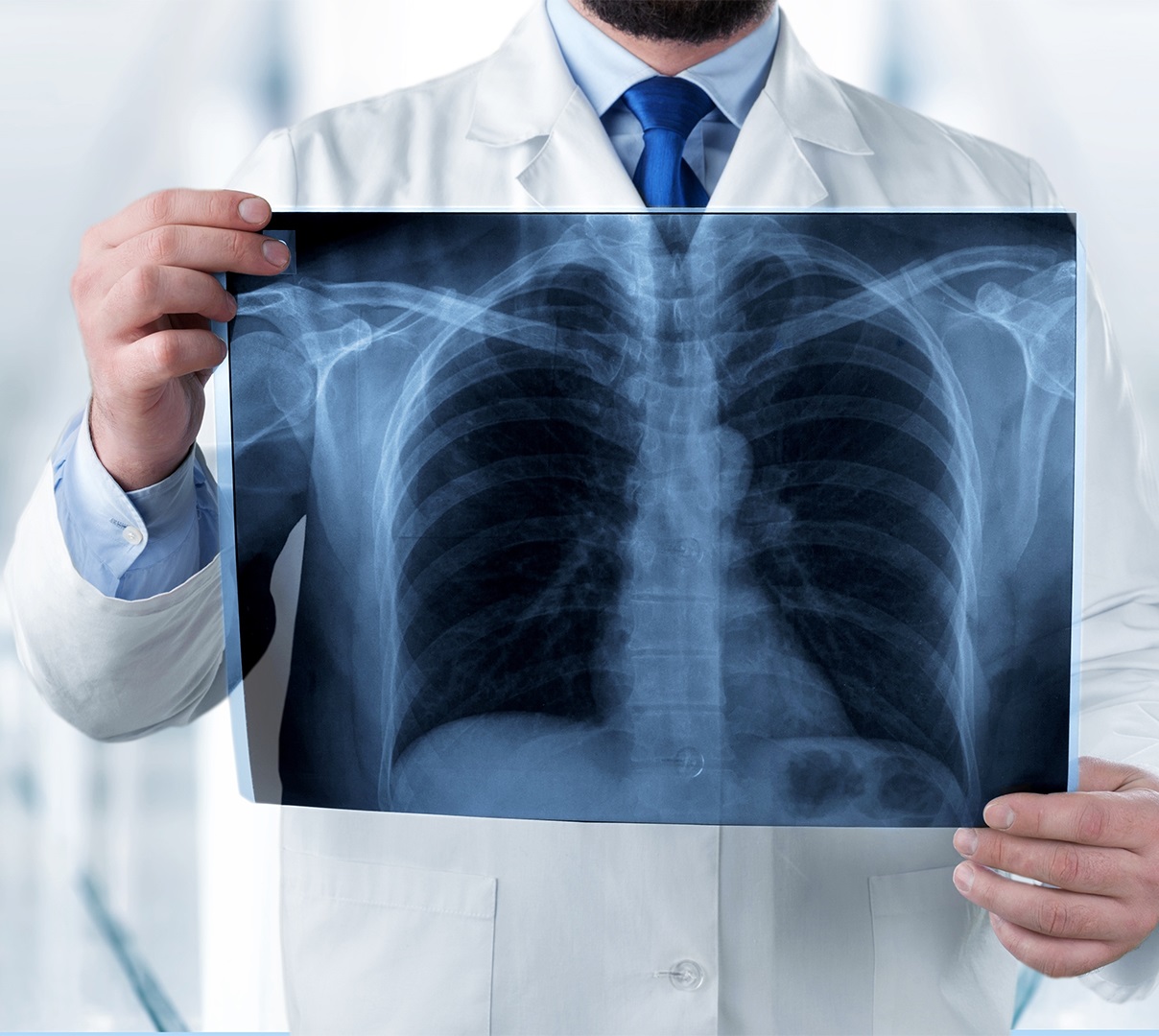 radiologia digitale